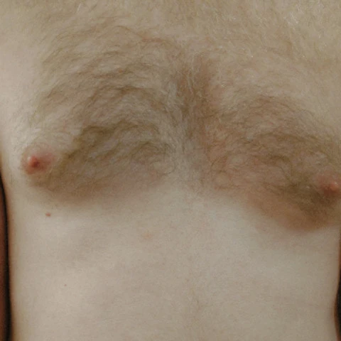Anonymous42o