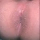 Envidebite