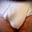 Albuterol_Flasher