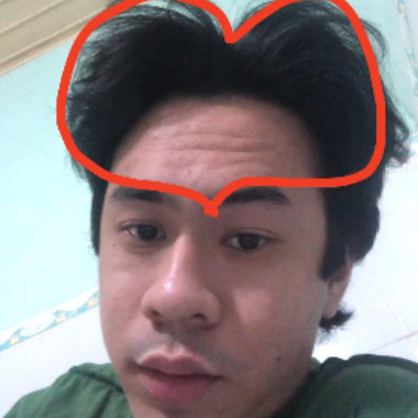 uynph20