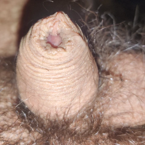 Seboses