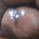Forsexholic