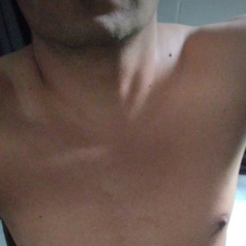 untiponormal3