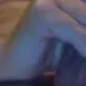 blastberez1