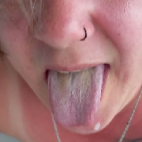 Tannilie