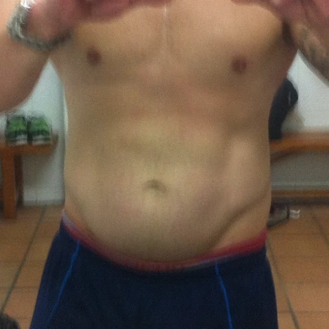 met31