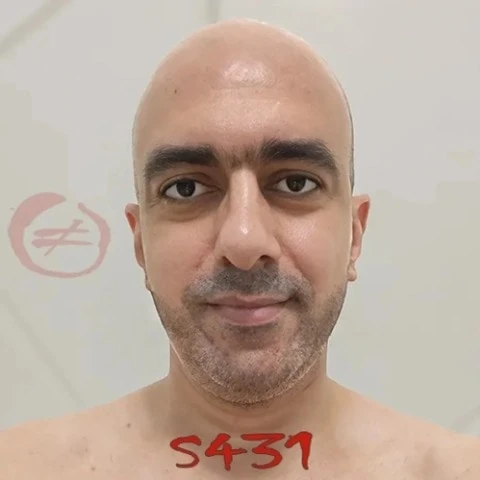 AAYAADX