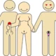 cuckoldbracnipar