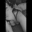 M_linaBlw