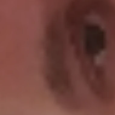 Gueritocochon
